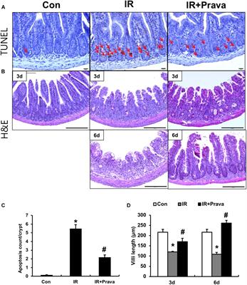 Pravastatin Attenuates Acute Radiation-Induced Enteropathy and Improves Epithelial Cell Function